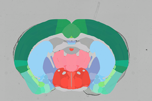 Brain Atlas Analyzer